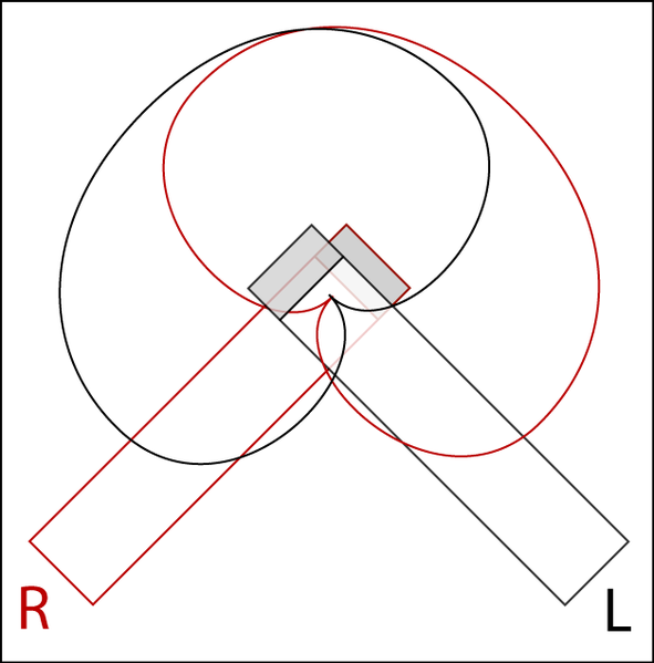 591px-XY-Stereo.png